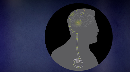 KION покажет фильм «Чип внутри меня» о людях с имплантами