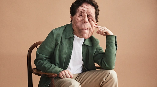 Звезда «Другого человека» Адам Пирсон сыграет в экранизации «Человека-слона»